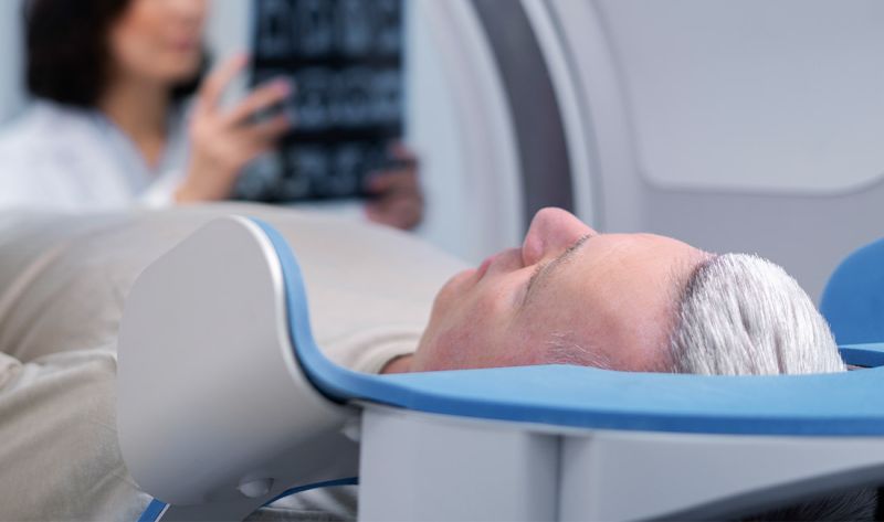 MR angiografija - dijagnostika krvnih sudova