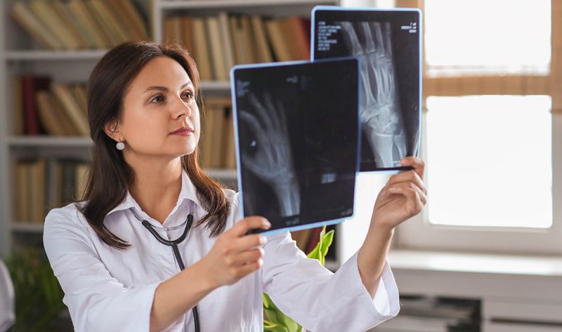 Rendgen ruku - specijalistički pregled