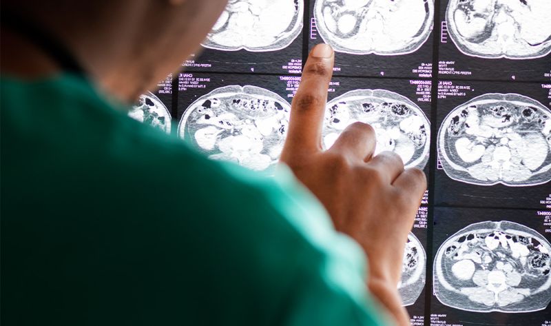 MR glave - dijagnostičko snimanje