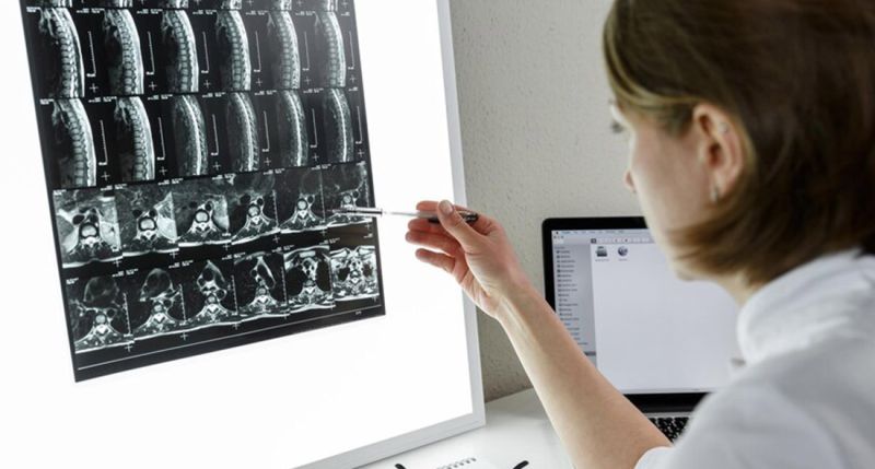 MR kičme - specijalističko snimanje