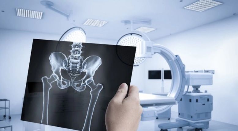 Rendgen karlice - specijalističko snimanje