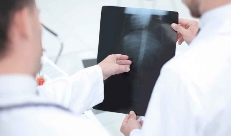 Rendgen kičme - radiološki pregled