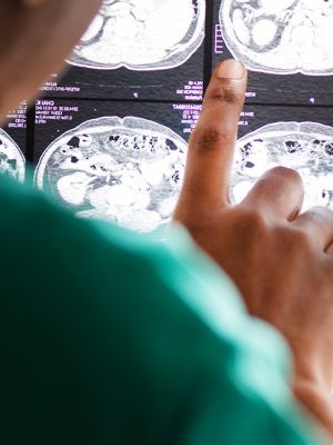 MR glave - dijagnostičko snimanje