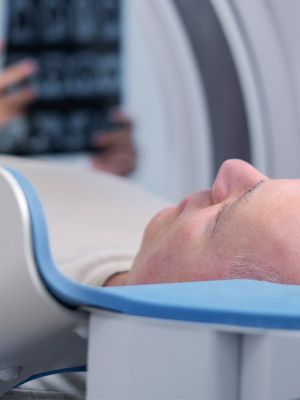 MR angiografija - dijagnostika krvnih sudova