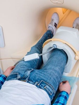 MR kolena - dijagnostički pregled