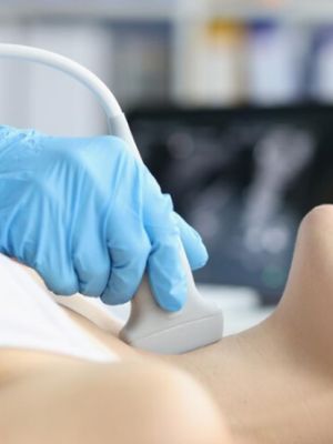 Kolor dopler krvnih sudova vrata