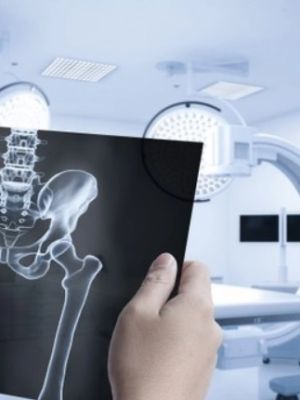 Rendgen karlice - specijalističko snimanje