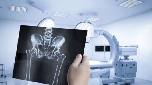 RTG karlice RTG karlice