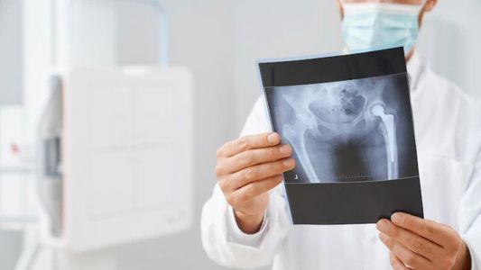 MSCT karlice MSCT karlice