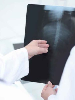 Rendgen kičme - radiološki pregled