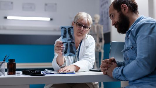 RTG pluća RTG pluća