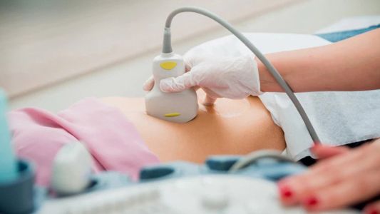 UZ mekih tkiva UZ mekih tkiva